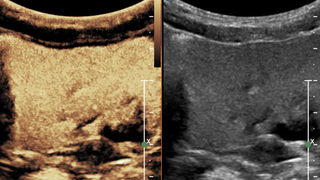 Advances in Imaging Urinary Conditions