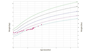 Laryngomalacia growth chart