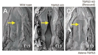 Normal palatal fusion process in embryos