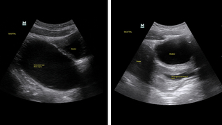 Point of care side-by-side ultrasound comparisons