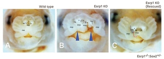 Reducing Sox2 gene dosage