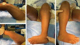 Preop clinical