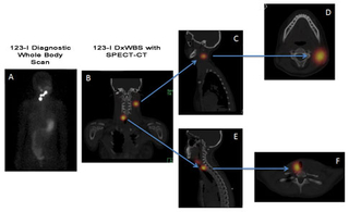 functional imaging