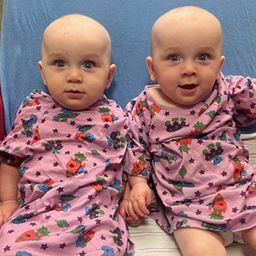 Newborn screening indicated Dean (left) and Danny (right) had Fabry disease