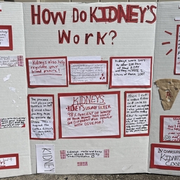 Aviva's science fair project: How Kidneys Work