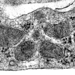 An image taken through scanning electron microscopy shows healthy mitochondria in brain endothelial cells from 22qDS animals treated with bezafibrate