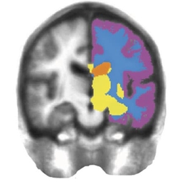 right brain image right brain image