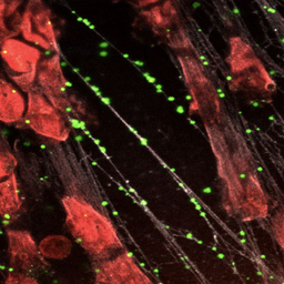 new sepsis treatment imaging new sepsis treatment imaging