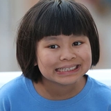 Emily, epilepsy patient