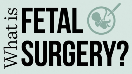 what is fetal surgery infographic title
