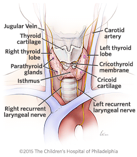 Hypothyroidism in children illustration