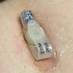 Tube is too tight example 1