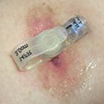 Tube is too tight example 2