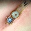 Tube is too tight example 3