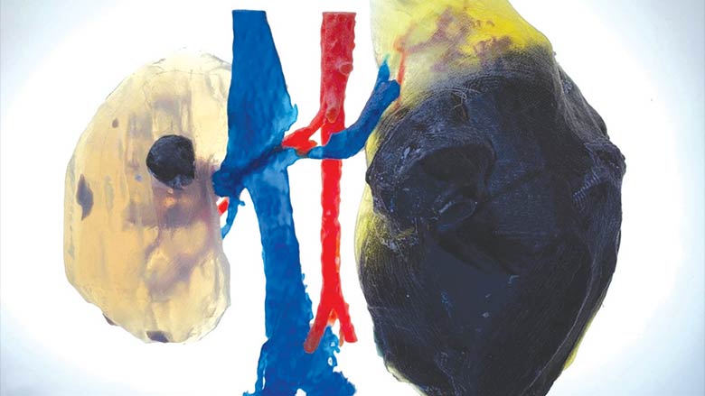 The Use of 3D Printing Technology in Advanced Pediatric Urologic Care The Use of 3D Printing Technology in Advanced Pediatric Urologic Care