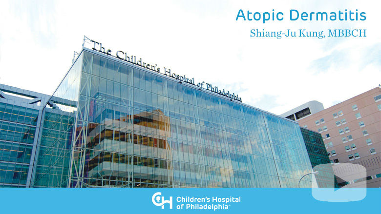 Allergy and Immunology – Atopic Dermatitis